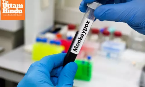 Africa CDC urges aggressive action to curb mpox outbreak in southern Ethiopia