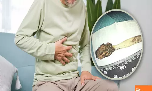Miracle in Medicine: 64-Year-Old Man Lives with Toothbrush in Intestine for 52 Years