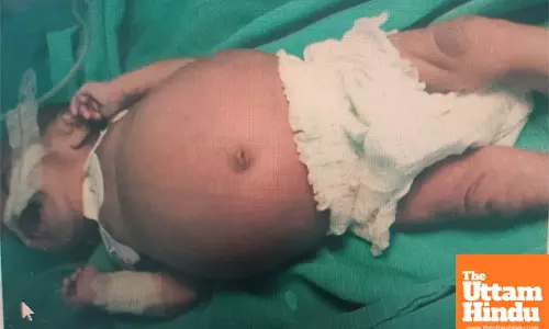 Shocking Medical Mystery in Hong Kong!  Baby Born with Her Own Twin Inside Her Abdomen