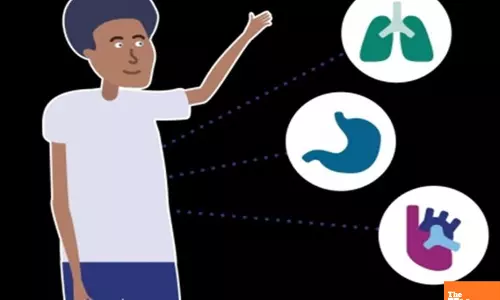 Policy reforms key to boost global equity in organ transplantation: Lancet