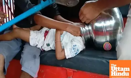 Playing Turns Risky: 3-Year-Old Toddler’s Head Gets Stuck in Steel Pot, Firefighters Rush to Save Him