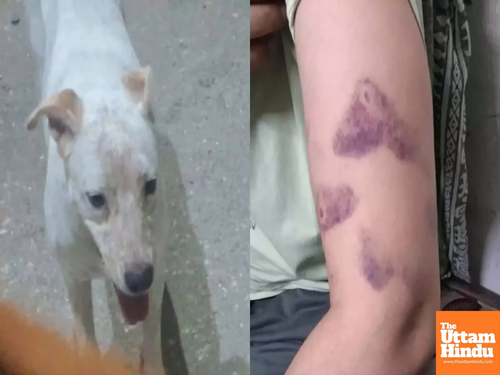 Delhi Woman Bitten After Asking to Move Dog from Stairs, Escapes Delhi Woman Bitten After Asking to Move Dog from Stairs, Escapes
