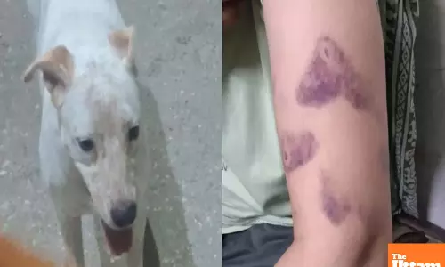 Delhi Woman Bitten After Asking to Move Dog from Stairs, Escapes