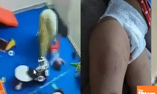 Day Care Horror: Maid Throws Girl, Beats with Belt, and Bites Her