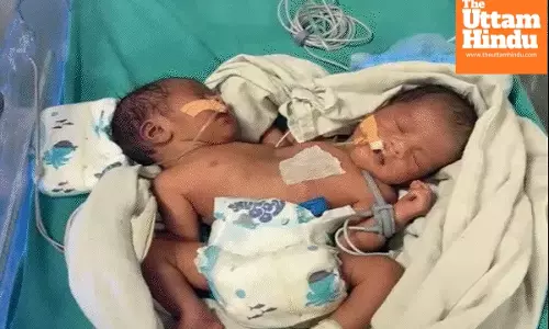 Shock in Indore: Woman Gives Birth to Baby with Two Heads, Two Hearts and Four Arms