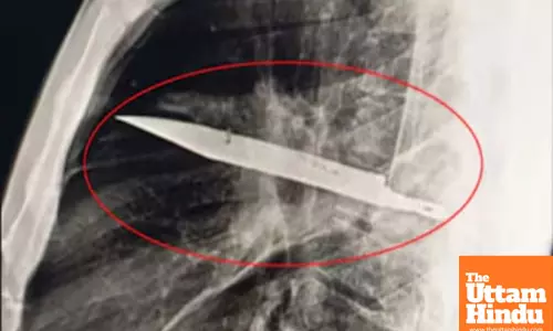 Man Lives with Knife Blade in Chest for 8 Years : A Remarkable Medical Case