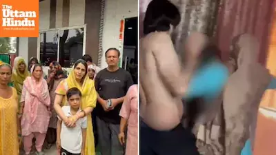 Woman Set Ablaze Over Dowry in Greater Noida, Husband Arrested Woman Set Ablaze Over Dowry in Greater Noida, Husband Arrested