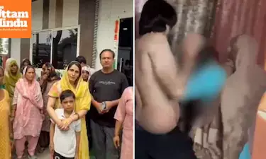 Woman Set Ablaze Over Dowry in Greater Noida, Husband Arrested