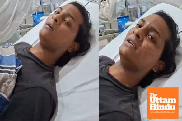 UPSC aspirant self-harms in attempt to change gender, condition critical UPSC aspirant self-harms in attempt to change gender, condition critical