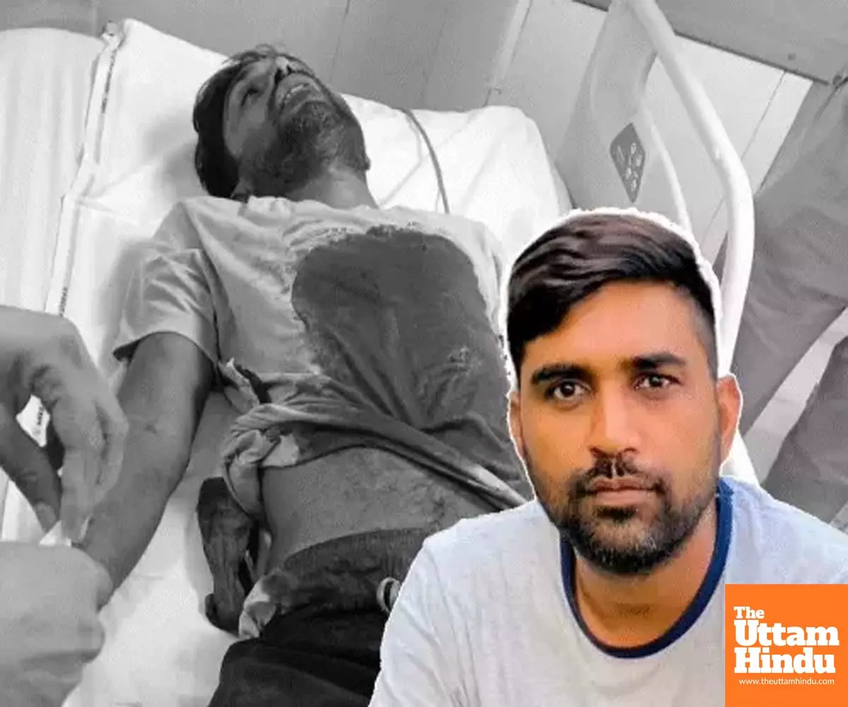 Congress leader’s brother shot dead in Ludhiana, 3 assailants flee on bike