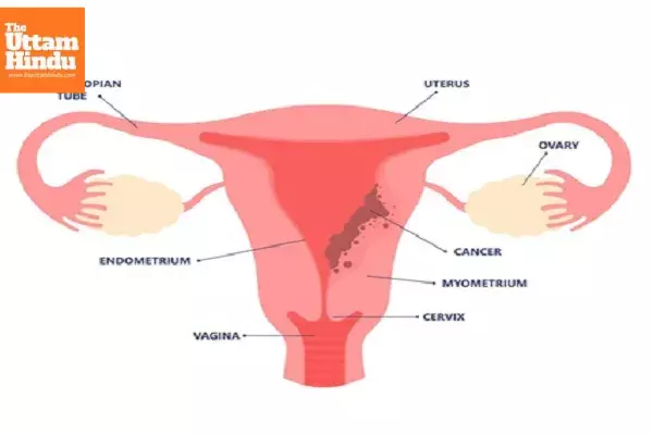 Womens health alert: Stress and sleep deprivation linked to hormonal imbalance