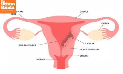 Womens health alert: Stress and sleep deprivation linked to hormonal imbalance