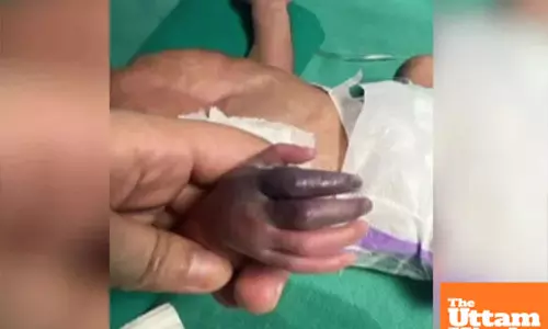 Wrong injection turns devastating: Newborns hand needs amputation due to nursing home negligence