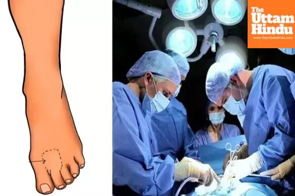 Miracle surgery in Delhi! Doctors make thumb from toe at Sir Ganga Ram Hospital Miracle surgery in Delhi! Doctors make thumb from toe at Sir Ganga Ram Hospital
