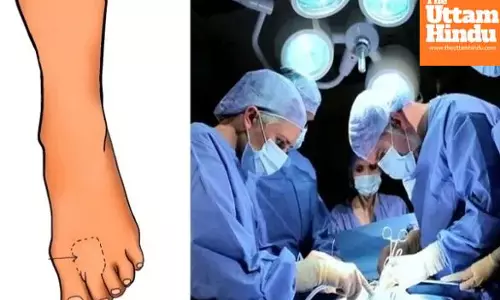 Miracle surgery in Delhi! Doctors make thumb from toe at Sir Ganga Ram Hospital