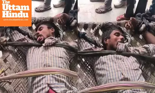 Rabies-like symptoms appear in youth within 18 hours of dog bite, runs to bite others, panic grips village