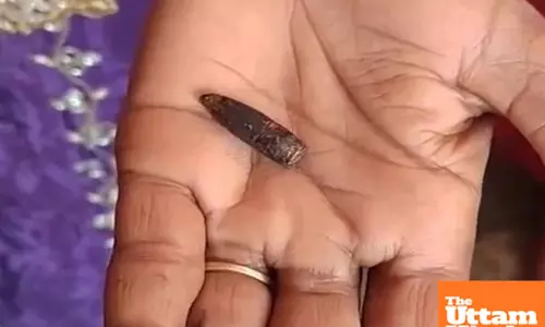 20-Year mystery: Woman unknowingly carries bullet, boil bursts to reveal surprising secret