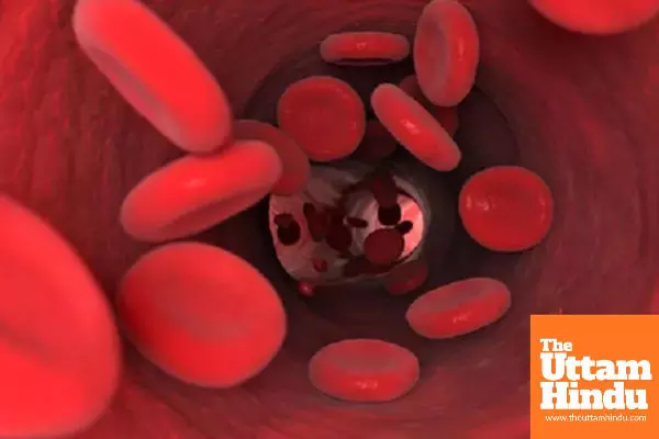 Low hemoglobin during pregnancy is dangerous for both mother and baby, stay safe with these measures Low hemoglobin during pregnancy is dangerous for both mother and baby, stay safe with these measures