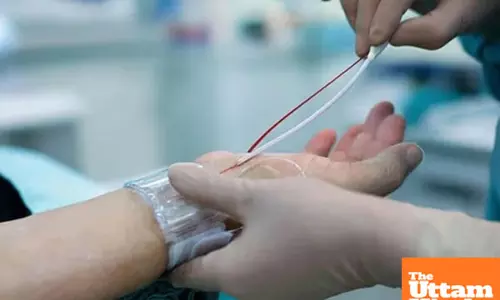 Understanding Angiography: A crucial test for heart health