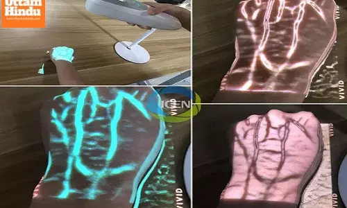 China unveils  revolutionary vein viewing machine: watch the amazing video