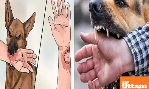 Punjab Health Dept on alert: 7 family members show Rabies symptoms after dog bite incident