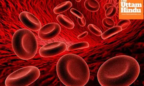 Global Anemia Day: WHO warns nearly 2 billion people worldwide suffer from the ‘silent epidemic’